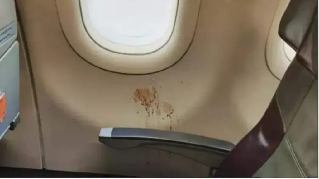 Gutka Stain