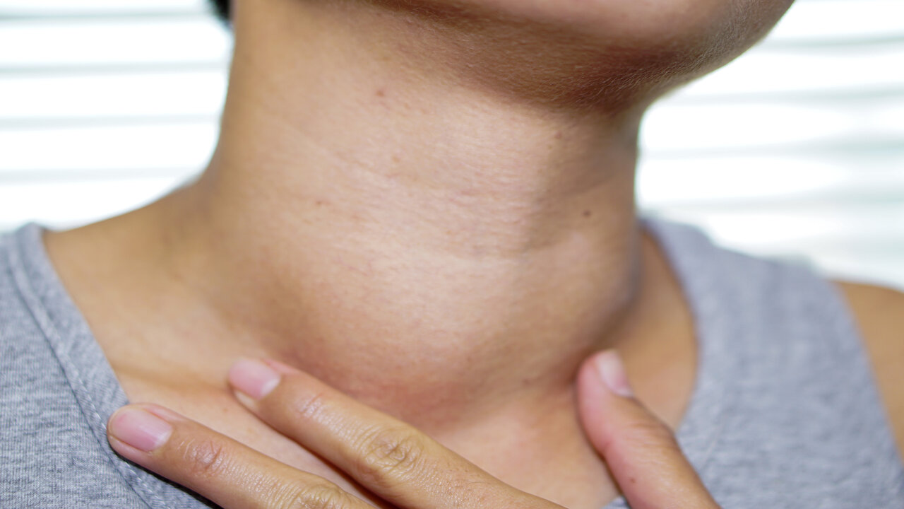 Thyroid Disease: “థైరాయిడ్” వస్తే క్యాబేజీ, కాలీ ఫ్లవర్ తినొచ్చా..?