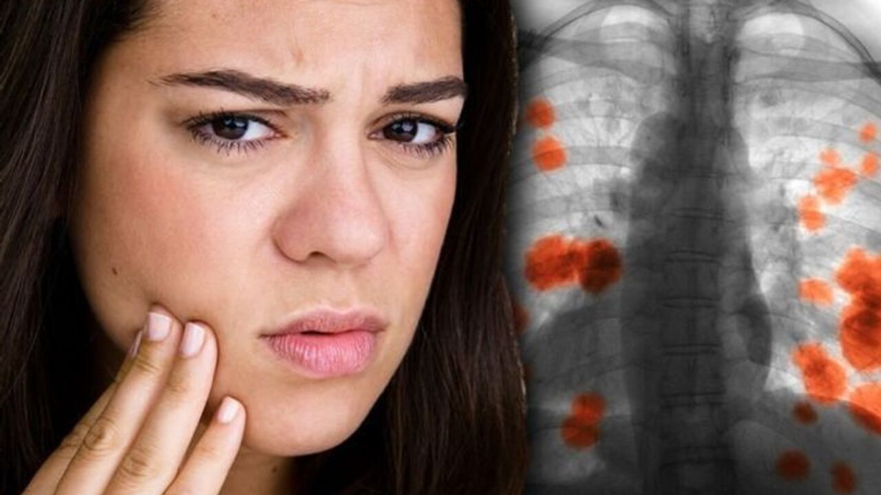 Lung Cancer: ముఖ భాగంలో లంగ్ క్యాన్సర్ గుర్తించడం ఎలా?