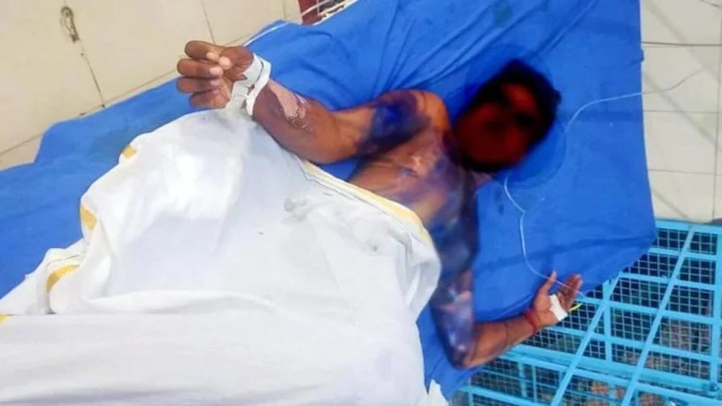 Husband Attacked Imresizer