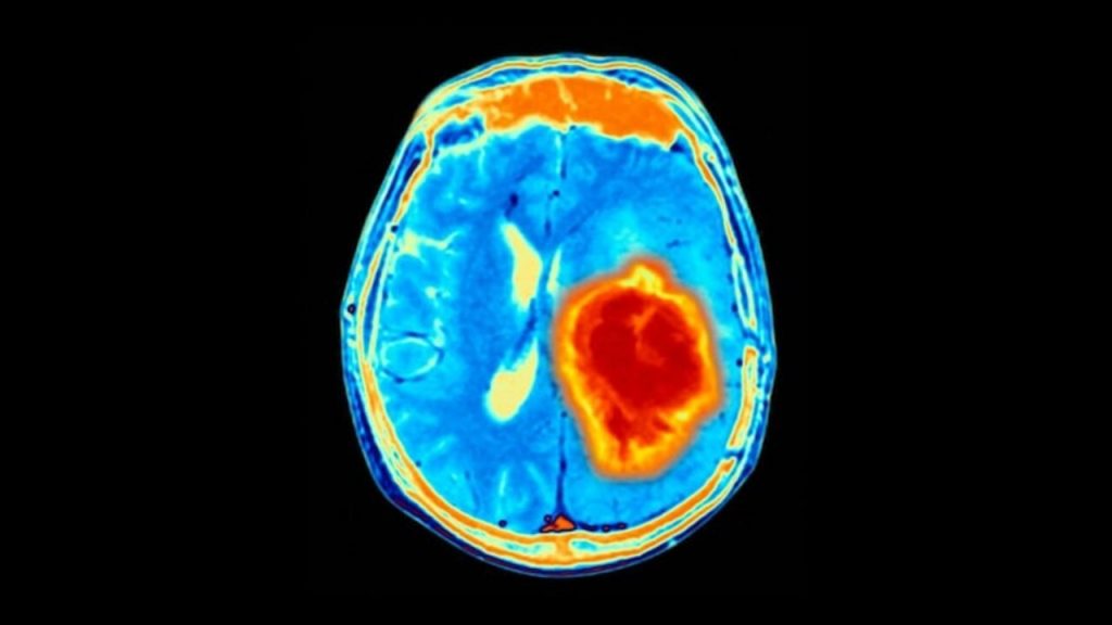 Brain Neuro