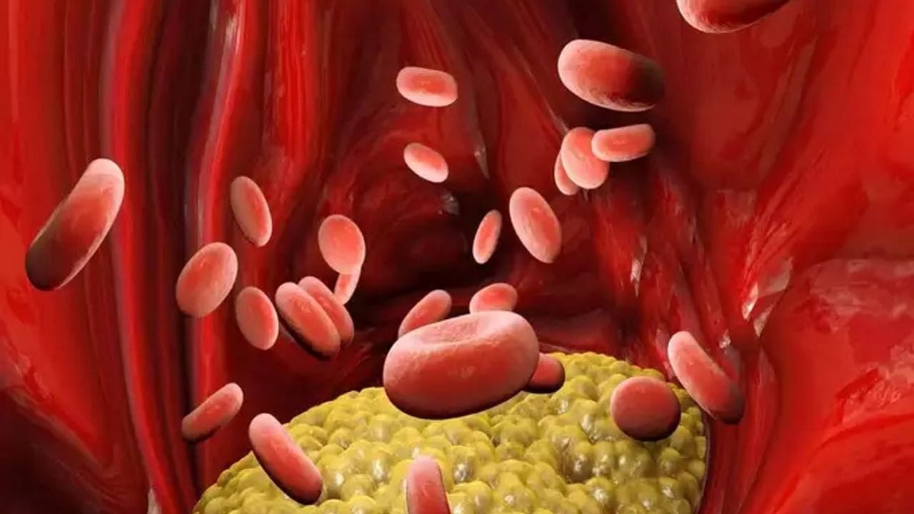 Cholesterol: కొలెస్ట్రాల్ ఉన్నవారు వీటిని తింటే ప్రాణానికి ప్రమాదం.. అవేంటంటే?