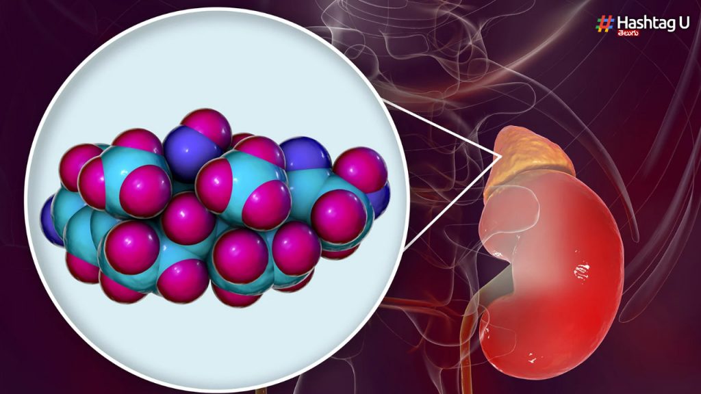 Cortisol Hormone