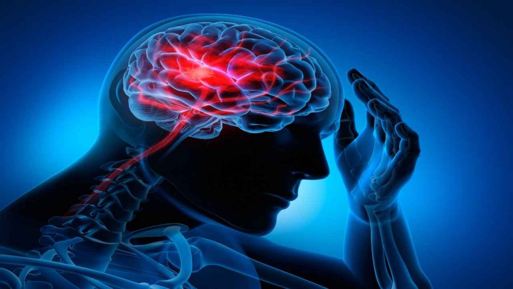 brain stroke