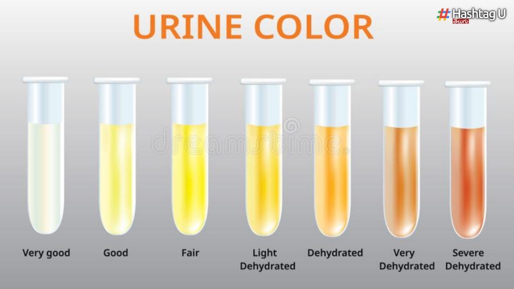 Do You Know What Happens If The Color Of The Urine Changes