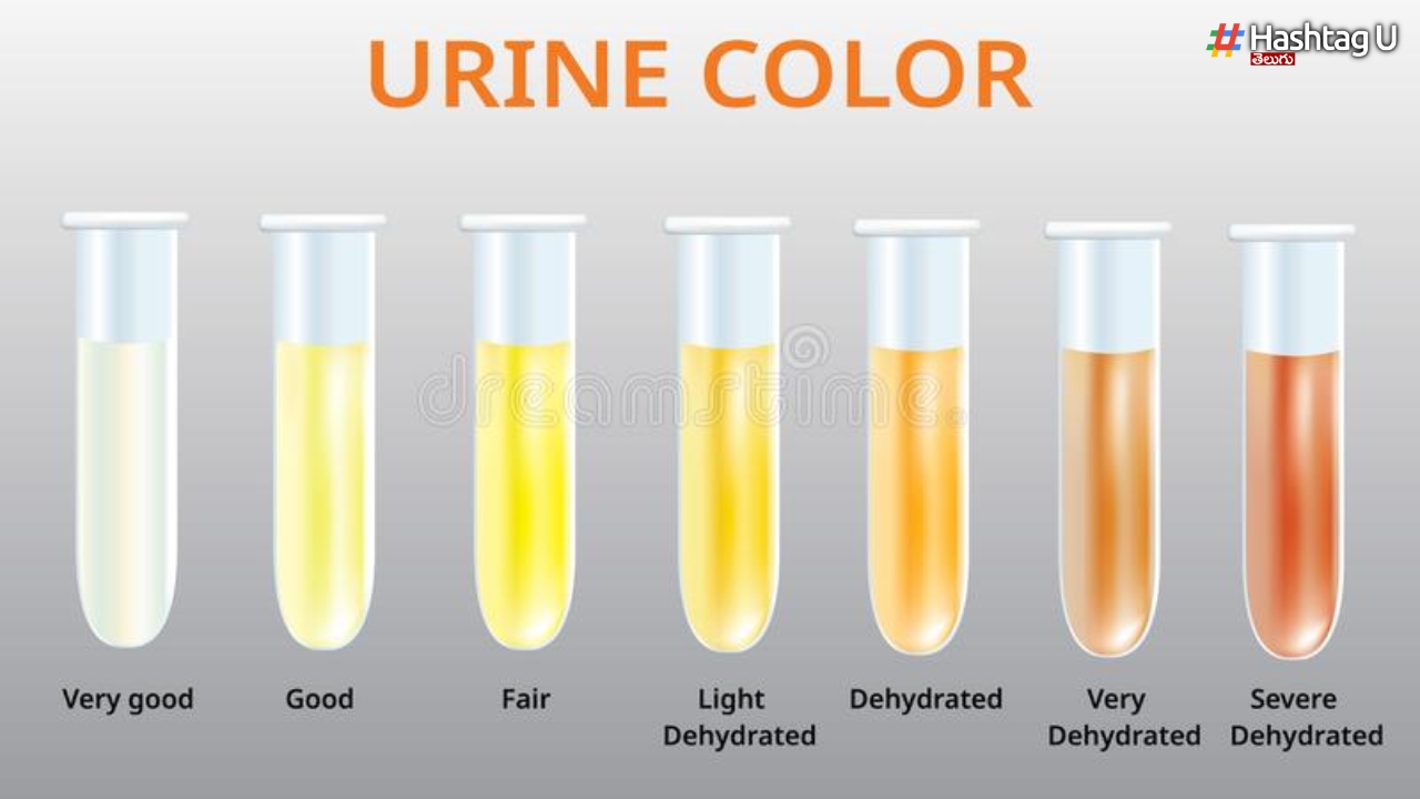 Urine మూత్రం రంగు మారితే.. ఏం జరిగినట్టో తెలుసా?