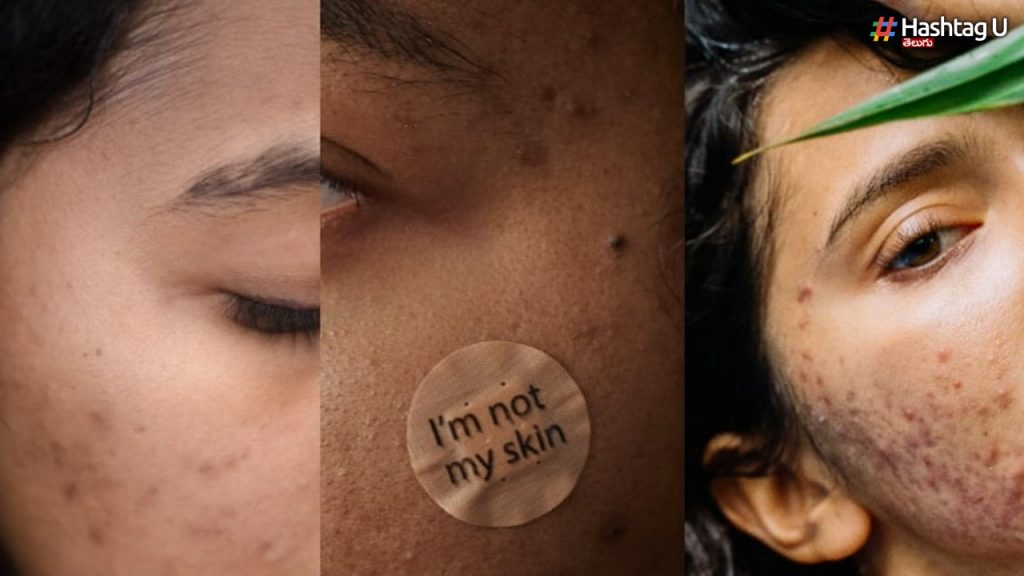 Got Sensitive Skin Try Avoiding These Skincare Ingredients In Your Routine