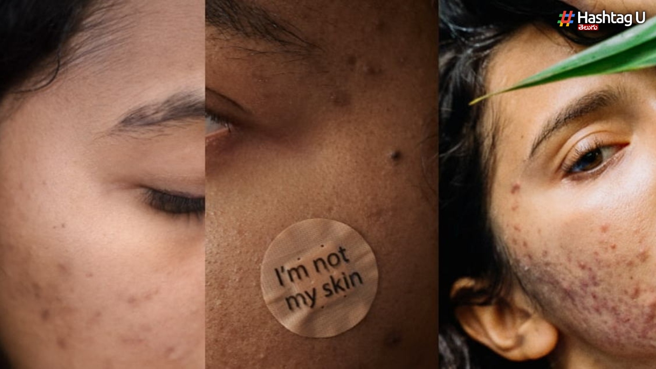 Sensitive Skin: సెన్సిటివ్ స్కిన్ ఉందా? ఈ పదార్ధాలను నివారించడానికి ప్రయత్నించండి