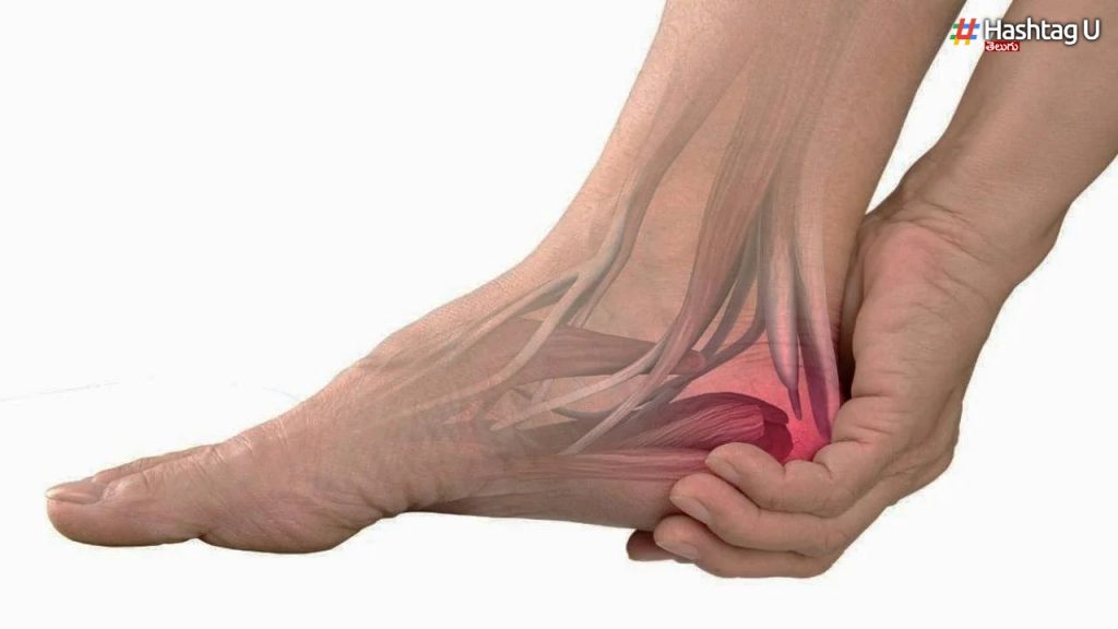 Uric Acid.. Gout Problems