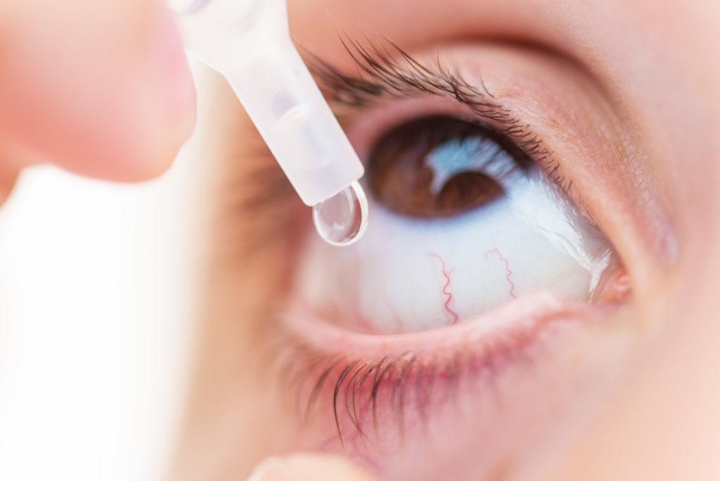 Closeup Of Young Girl Applying Eyedrops On The Eye