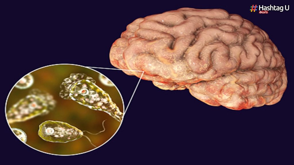Brain Eating Amoeba