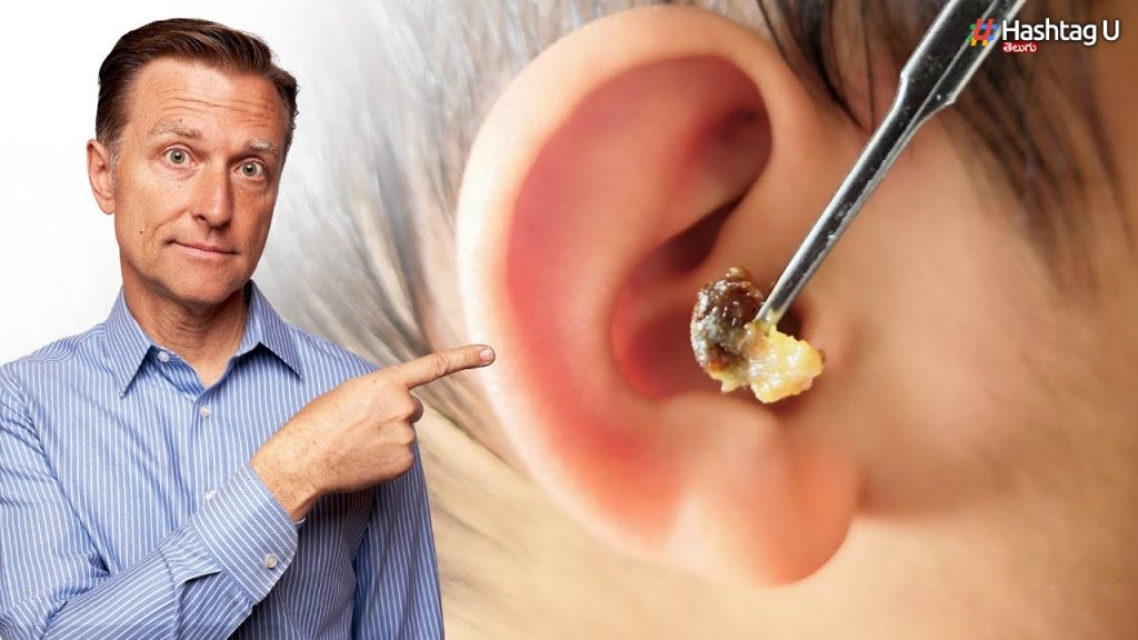 If You Take The Lump.. Put Your Hand To The Ear