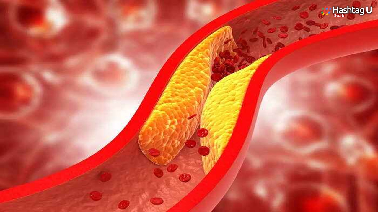 Cholesterol: కొలెస్ట్రాల్‌ ను కంట్రోల్ చేసేందుకు ఈ ట్యాబ్లేట్ ట్రై చేయండి..