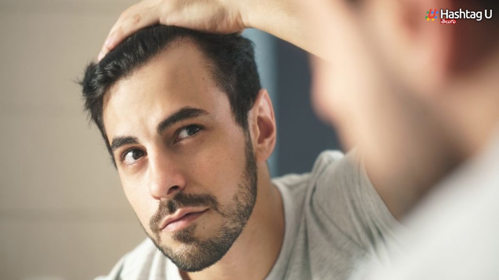 What Precautions Need To Be Taken To Avoid Baldness..