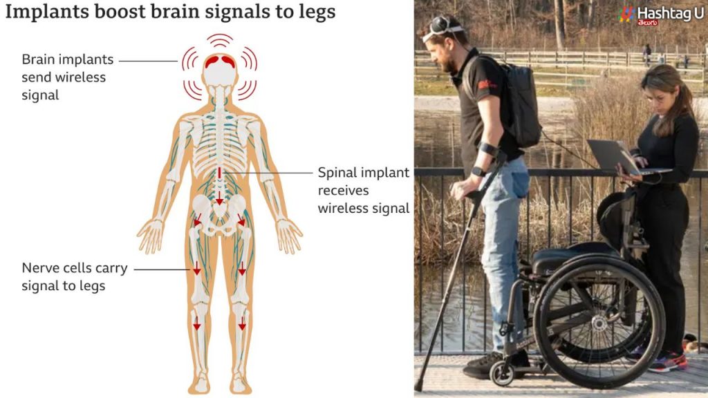 Victory On Paralysis