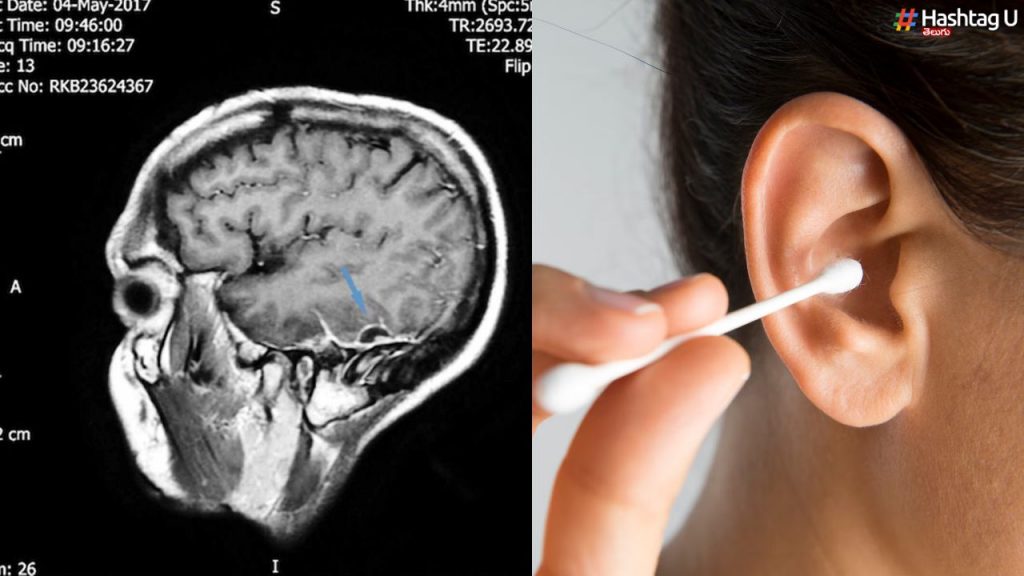Cotton Ear Buds Vs Ear Wax 