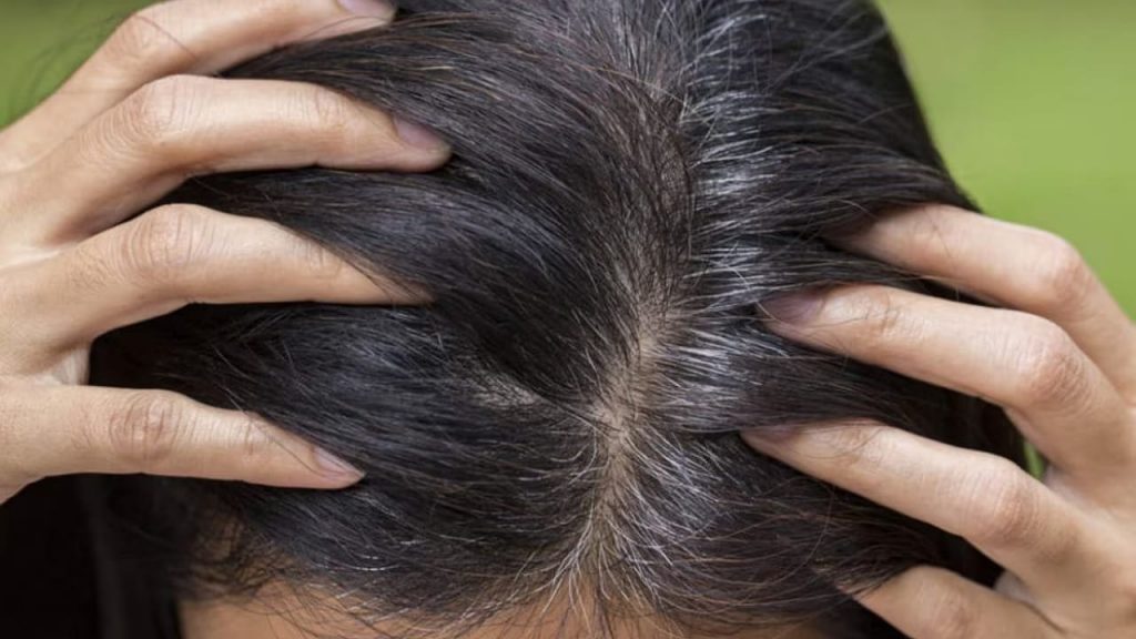Grey Hairgrey Hair
