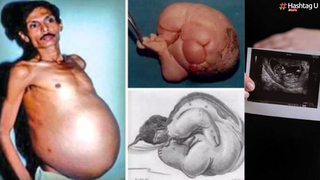Pregnant Man