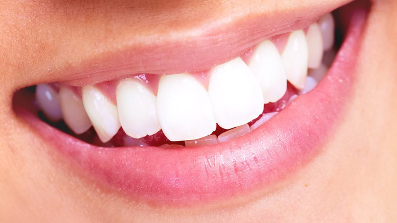 White Teeth: పళ్ళు తల తల మెరవాలంటే.. ఇలా చేయాల్సిందే?