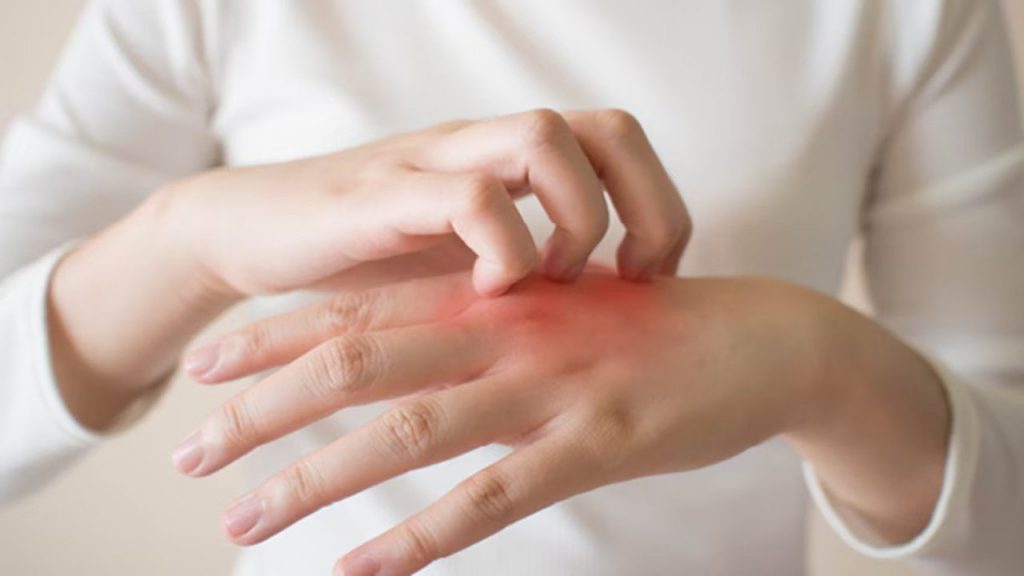Fungal Infections