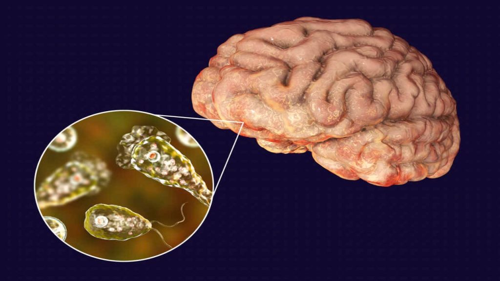 Brain-Eating Amoeba