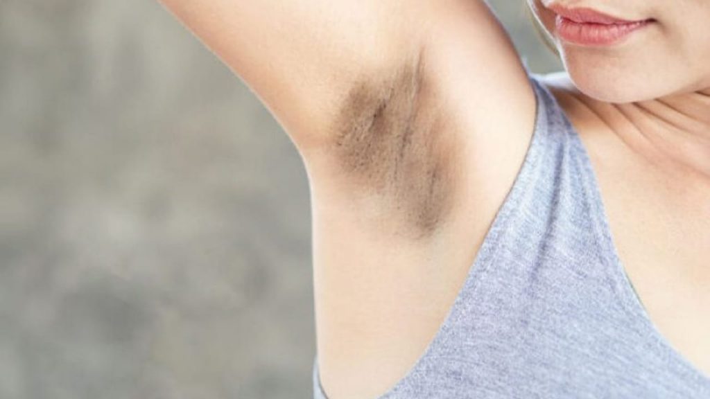 Underarms