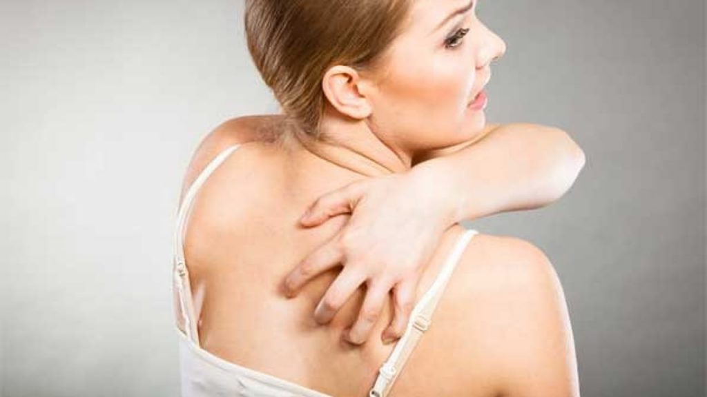 Back Acne Reducing Tips