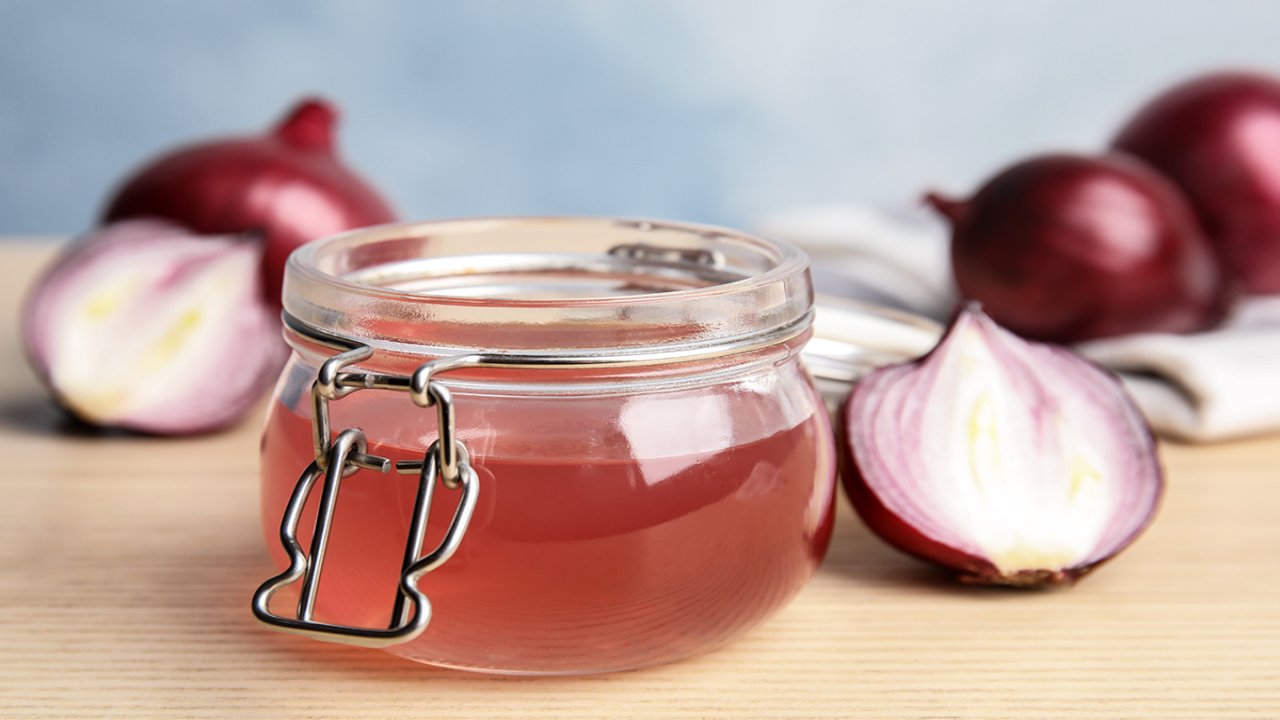 Onion Juice: ఉల్లిపాయ రసం జుట్టుకు హానికరమా..? నివేదికలు ఏం చెబుతున్నాయంటే..?