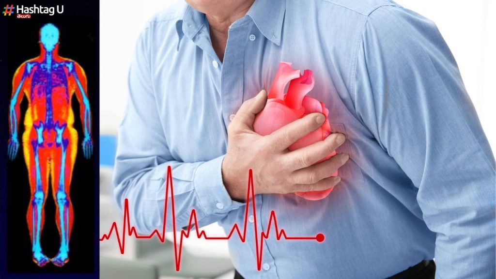 Dexa Scan Vs Heart Attack