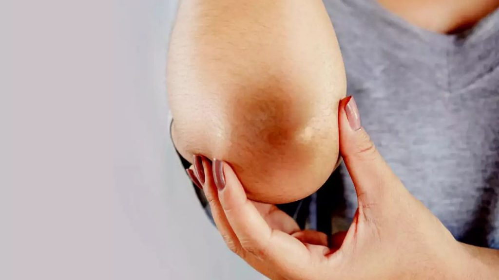 Dark Elbows