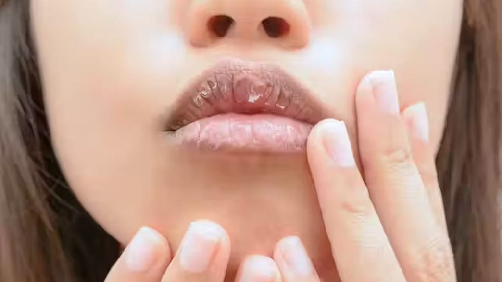 Lips