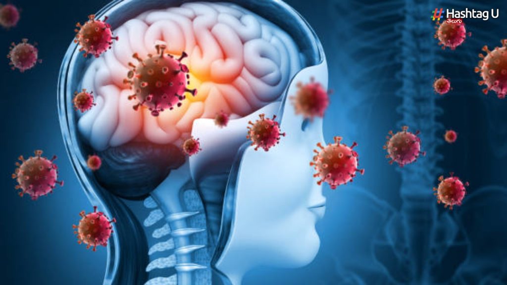 Nipah Virus