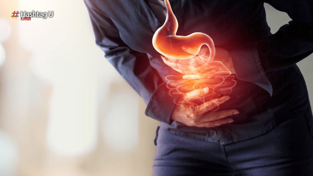 Ulcers