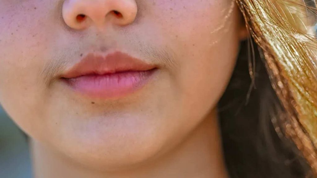 Unwanted Hair