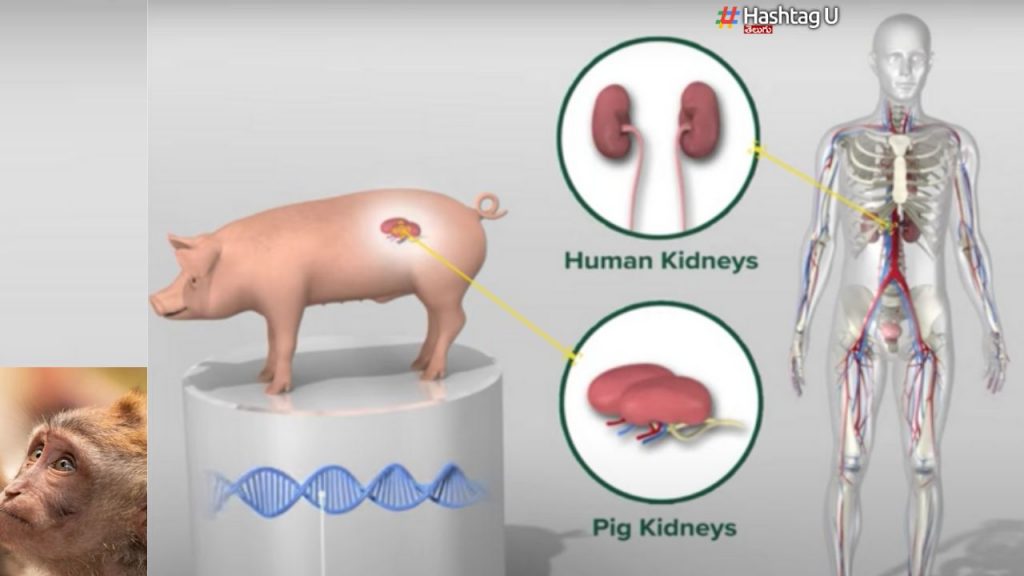 Monkey With Pig Kidney