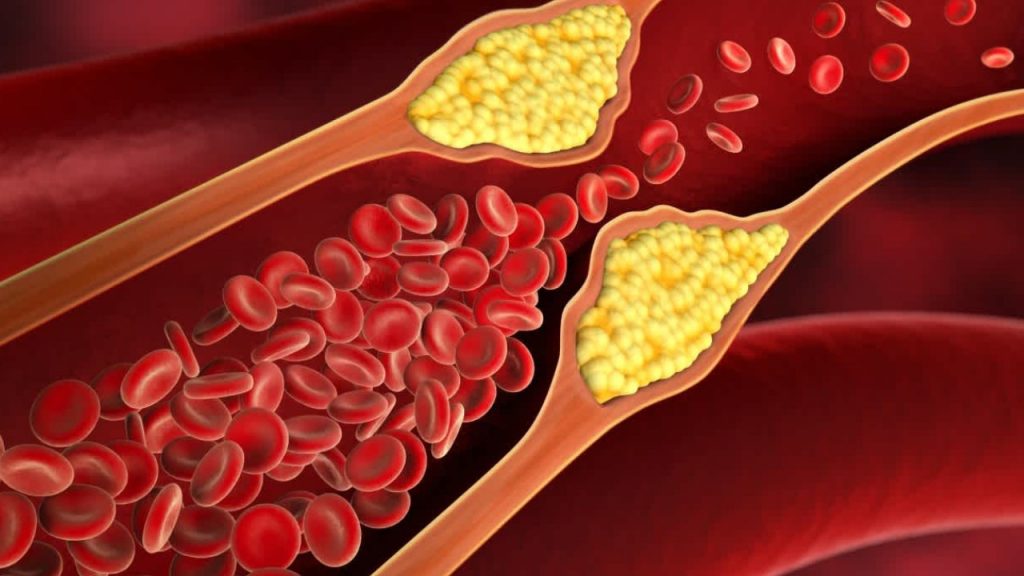 bad choleserol reduce drinks