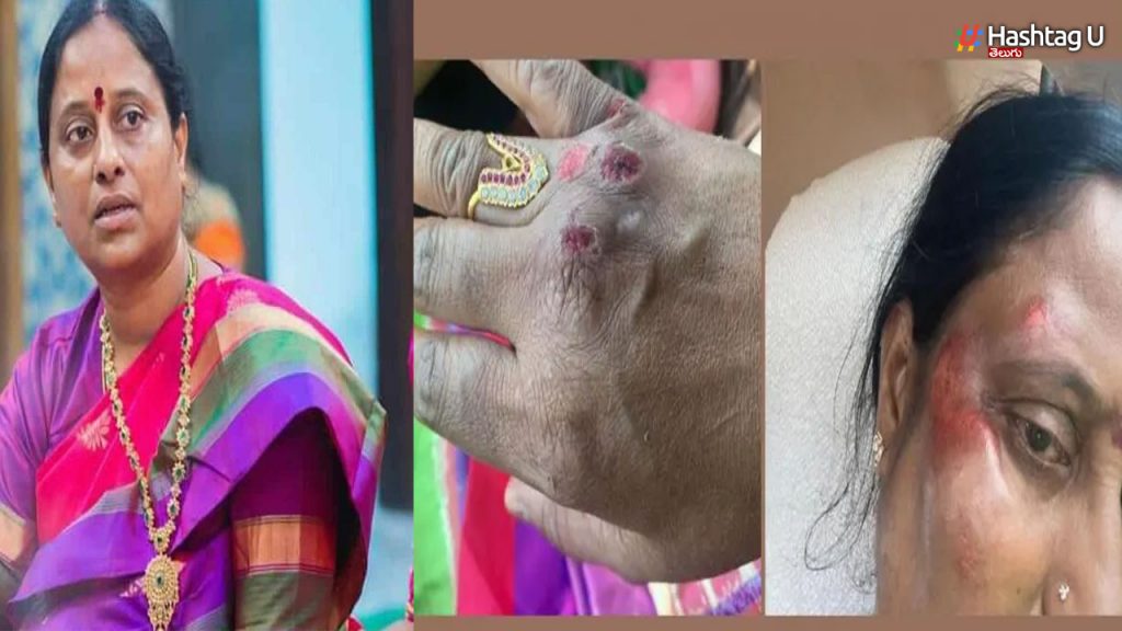 Konda Surekha