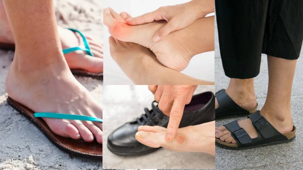 Follow these Remedies for New Slippers Problems to Legs