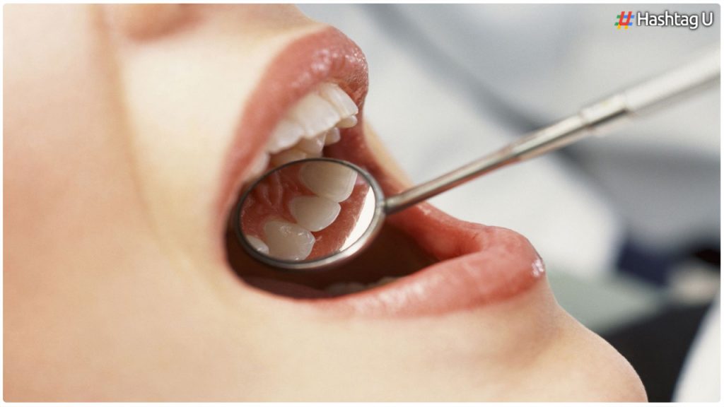 Are You Suffering From Dental Problems During Winters.. But Should You Follow These Tips..