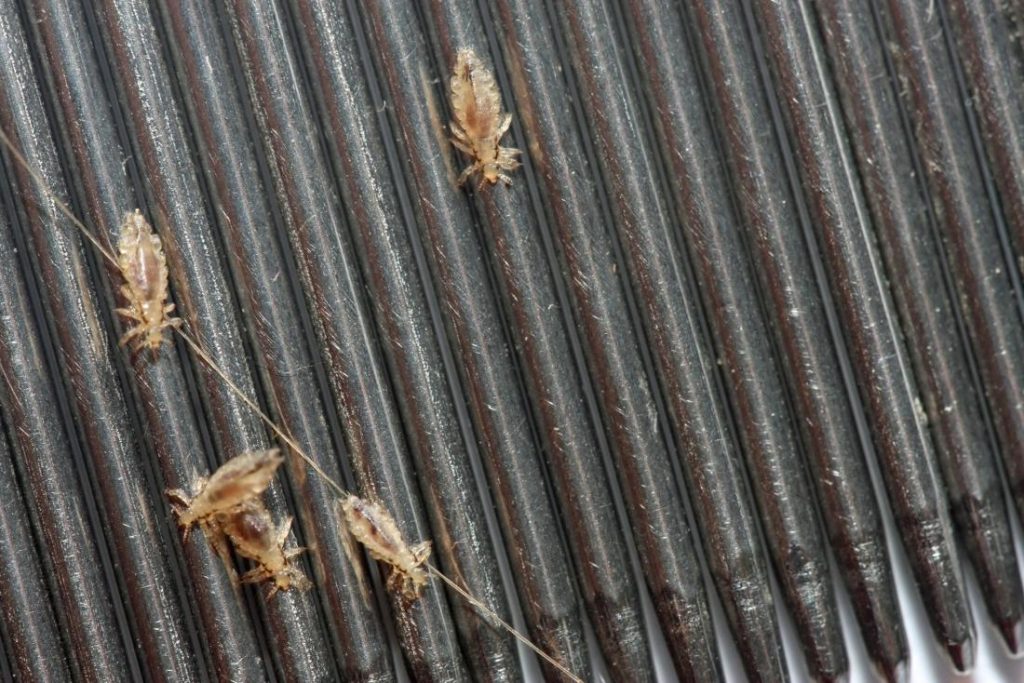 Close Up Of Head Lice On A Comb