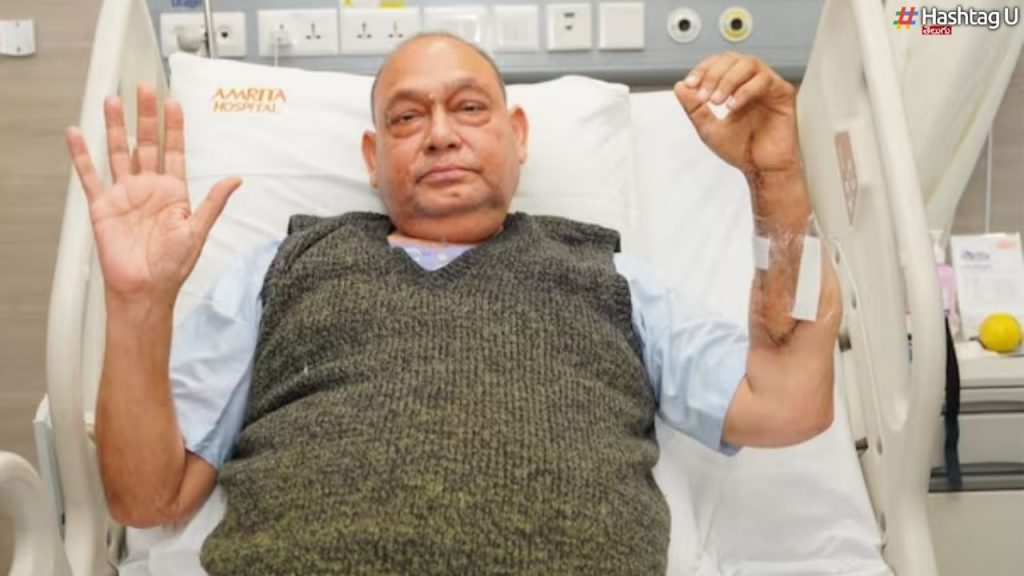 Hand Transplant Surgery