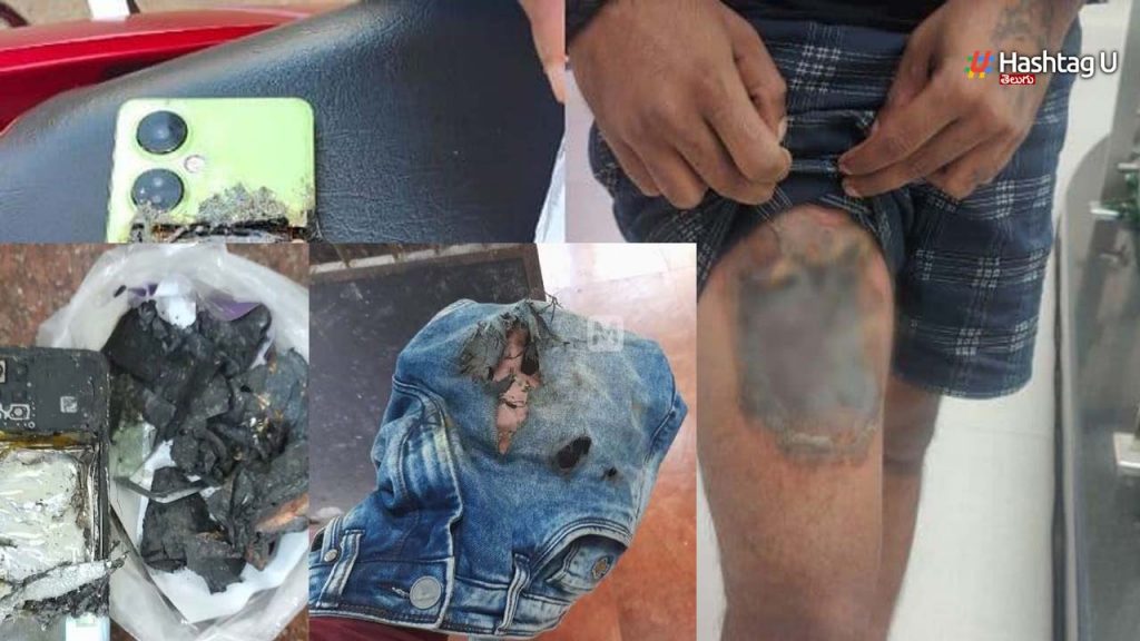New Oneplus Device Explodes