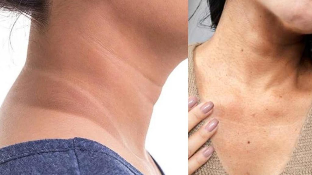 How to Reduce Darkness on Neck follow these Remedies