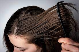 Oily Hair : జుట్టు జిడ్డుగా ఉందా.. అయితే నూనెలో ఇది కలిపి రాయాల్సిందే?