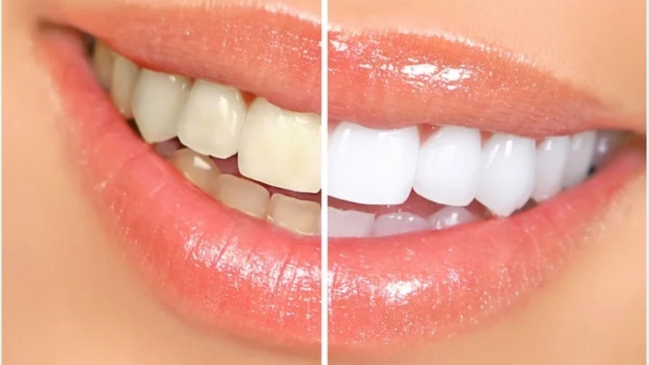 Teeth Whitening: పళ్ళు తెల్లగా మెరిసిపోవాలంటే పేస్టులో ఇవి కలిపి శుభ్రం చేసుకోవాల్సిందే?