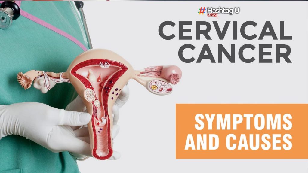 Cervical Cancer