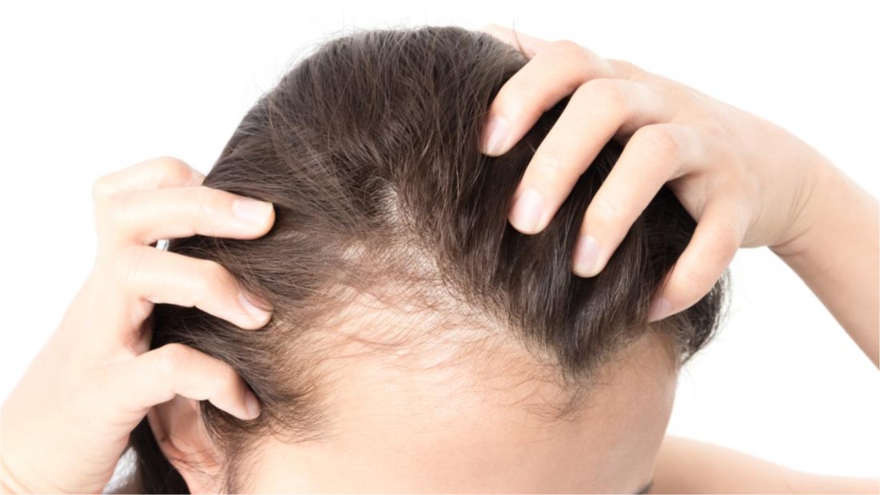 Hair Fall: జుట్టు ఎక్కువగా రాలిపోతోందా.. అయితే వెంటనే ఇలా చేయండి?