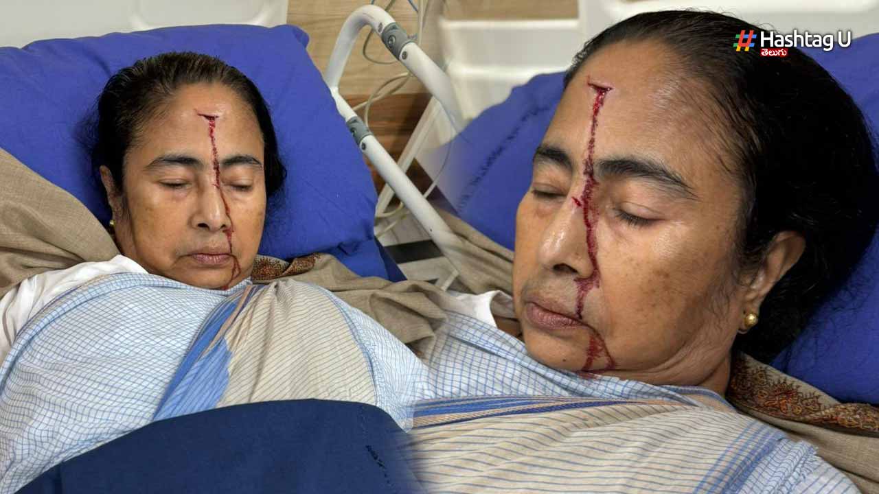 Mamata Banerjee is Injured : బెంగాల్ సీఎం మమతా బెనర్జీ కి తీవ్ర గాయం..హాస్పటల్ లో చేరిక