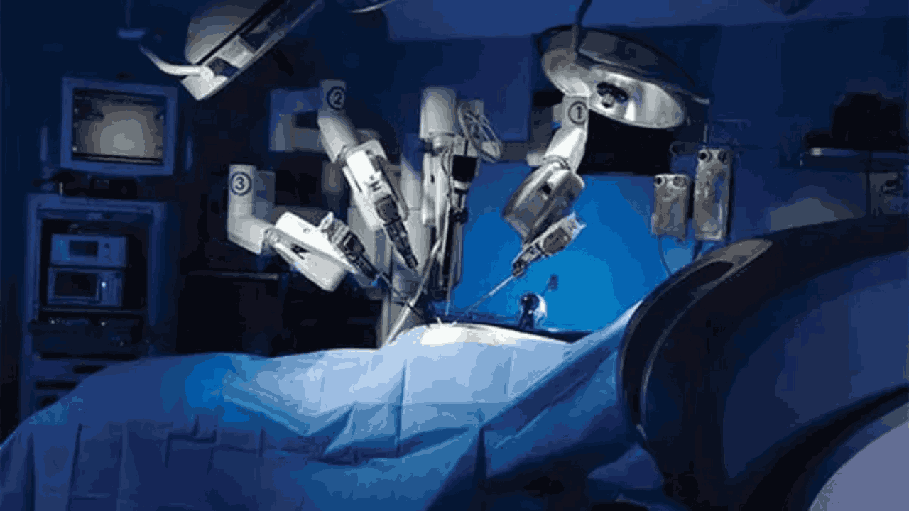 Robotic Kidney Transplant: రోబోతో కిడ్నీ మార్పిడి.. అస‌లు రోబోటిక్ కిడ్నీ మార్పిడి అంటే ఏమిటి..?
