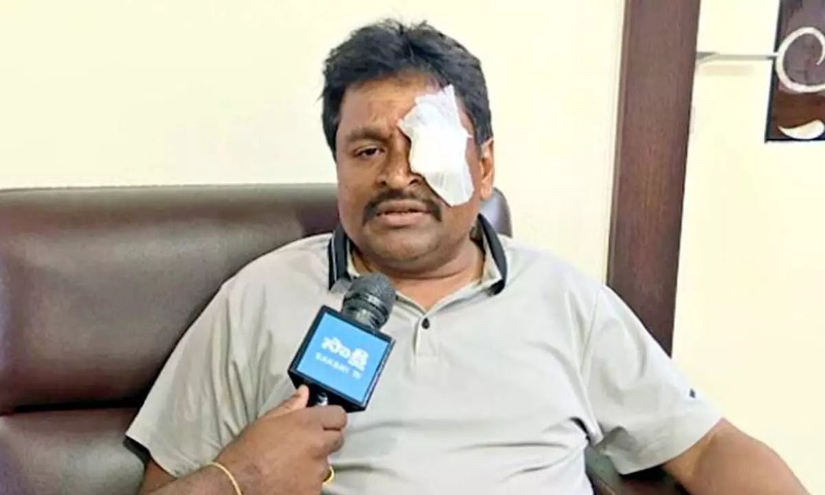 CM Jagan Attack: జగన్ దాడి కేసులో నిందితుడికి నాన్ బెయిలబుల్… కేసు నమోదు